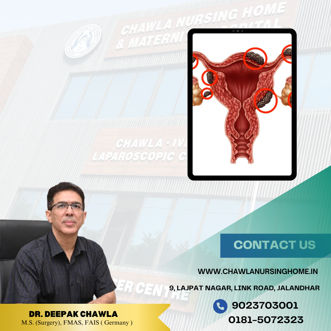 Dr. Deepak Chawla — Best Endometriosis Doctor in Kapurthala | Chawla Nursing Home | Kapurthala